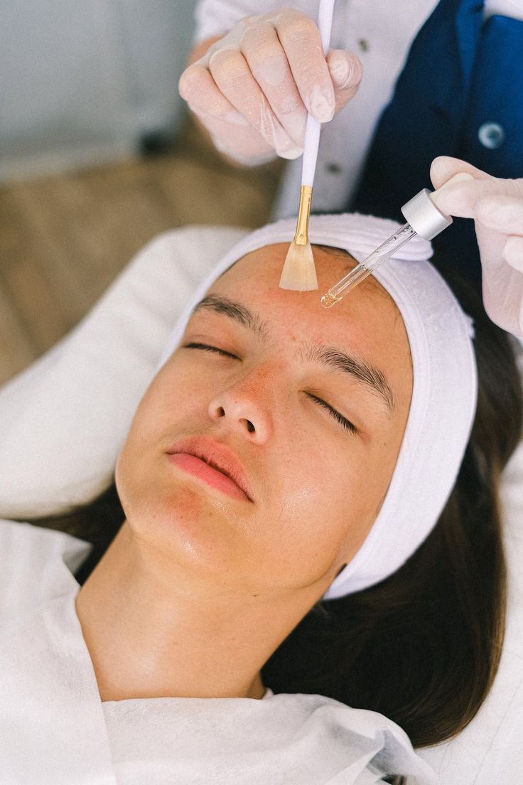 Cách phục hồi da sau peel an toàn, không bong tróc nặng